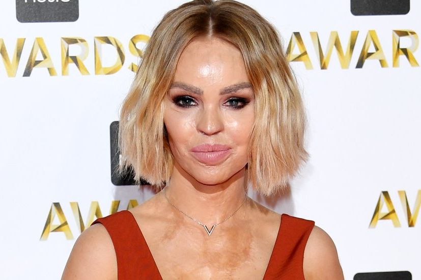 Katie Piper: “I Relied On Alcohol To Get Me Through Dark Times”