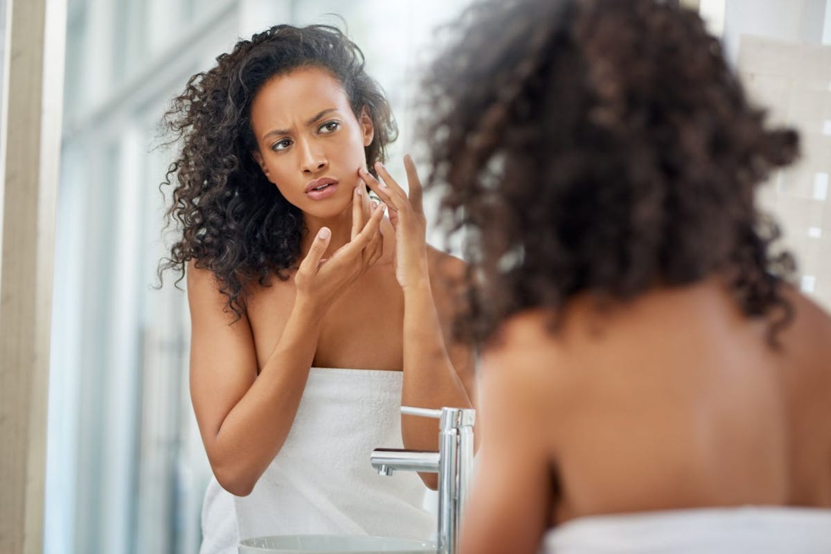 Acne scars on dark skin: how to treat hyperpigmentation